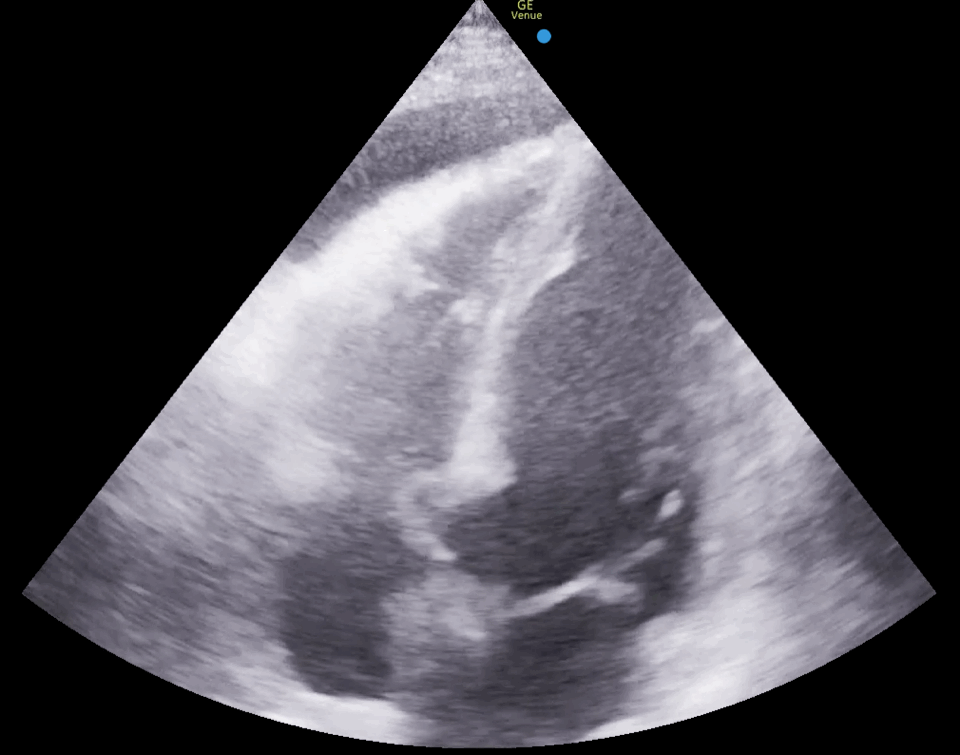 EEU case image missing